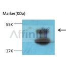 Western blot analysis of extracts from Mouse brain, using JNK1/2/3 Antibody. Lane 1 was treated with the blocking peptide.