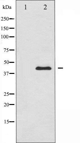 AF6319 at 1/100 staining Human breast cancer tissue by IHC-P. The sample was formaldehyde fixed and a heat mediated antigen retrieval step in citrate buffer was performed. The sample was then blocked and incubated with the antibody for 1.5 hours at 22¡ãC. An HRP conjugated goat anti-rabbit antibody was used as the secondary