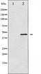 Western blot analysis of SEK1/MKK4 expression in NIH-3T3 whole cell lysates,The lane on the left is treated with the antigen-specific peptide.