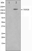 Western blot analysis on Jurkat cell lysate using TOP2B Antibody.The lane on the left is treated with the antigen-specific peptide.