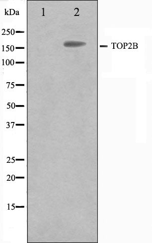 Western blot analysis on Jurkat cell lysate using TOP2B Antibody.The lane on the left is treated with the antigen-specific peptide.