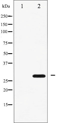 AF6324 staining A2780 by IF/ICC. The sample were fixed with PFA and permeabilized in 0.1% Triton X-100,then blocked in 10% serum for 45 minutes at 25¡ãC. The primary antibody was diluted at 1/200 and incubated with the sample for 1 hour at 37¡ãC. An  Alexa Fluor 594 conjugated goat anti-rabbit IgG (H+L) Ab, diluted at 1/600, was used as the secondary antibod