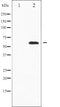 AF6331 at 1/100 staining Human prostate tissue by IHC-P. The sample was formaldehyde fixed and a heat mediated antigen retrieval step in citrate buffer was performed. The sample was then blocked and incubated with the antibody for 1.5 hours at 22¡ãC. An HRP conjugated goat anti-rabbit antibody was used as the secondary