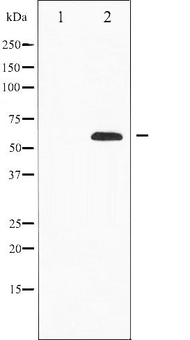AF6331 at 1/100 staining Human prostate tissue by IHC-P. The sample was formaldehyde fixed and a heat mediated antigen retrieval step in citrate buffer was performed. The sample was then blocked and incubated with the antibody for 1.5 hours at 22¡ãC. An HRP conjugated goat anti-rabbit antibody was used as the secondary