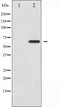 AF6332 at 1/100 staining Human prostate tissue by IHC-P. The sample was formaldehyde fixed and a heat mediated antigen retrieval step in citrate buffer was performed. The sample was then blocked and incubated with the antibody for 1.5 hours at 22¡ãC. An HRP conjugated goat anti-rabbit antibody was used as the secondary