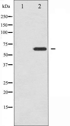 AF6332 at 1/100 staining Human prostate tissue by IHC-P. The sample was formaldehyde fixed and a heat mediated antigen retrieval step in citrate buffer was performed. The sample was then blocked and incubated with the antibody for 1.5 hours at 22¡ãC. An HRP conjugated goat anti-rabbit antibody was used as the secondary