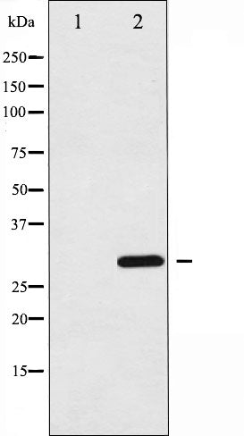 AF6333 at 1/100 staining Human breast cancer tissue by IHC-P. The sample was formaldehyde fixed and a heat mediated antigen retrieval step in citrate buffer was performed. The sample was then blocked and incubated with the antibody for 1.5 hours at 22¡ãC. An HRP conjugated goat anti-rabbit antibody was used as the secondary
