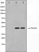 Western blot analysis on COS7 and HuvEc cell lysate using TRADD Antibody.The lane on the left is treated with the antigen-specific peptide.