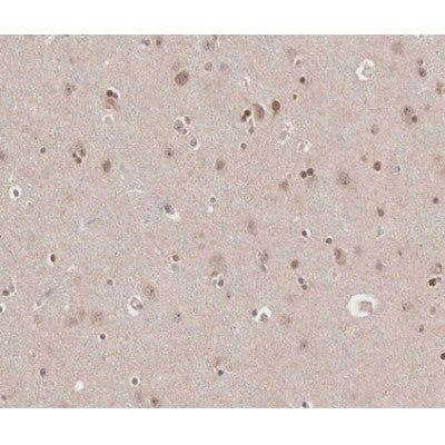 AF0284 at 1/100 staining human brain tissue sections by IHC-P. The tissue was formaldehyde fixed and a heat mediated antigen retrieval step in citrate buffer was performed. The tissue was then blocked and incubated with the antibody for 1.5 hours at 22¡ãC. An HRP conjugated goat anti-rabbit antibody was used as the secondary