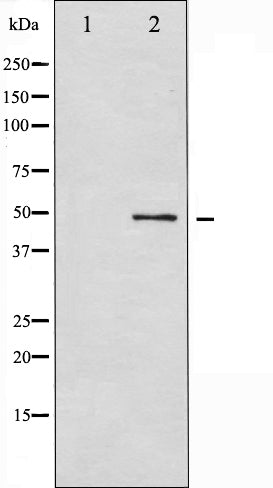 AF6336 at 1/100 staining Human prostate tissue by IHC-P. The sample was formaldehyde fixed and a heat mediated antigen retrieval step in citrate buffer was performed. The sample was then blocked and incubated with the antibody for 1.5 hours at 22¡ãC. An HRP conjugated goat anti-rabbit antibody was used as the secondary