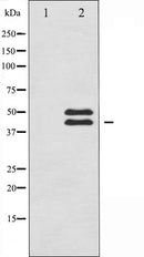 AF6338 staining HeLa by IF/ICC. The sample were fixed with PFA and permeabilized in 0.1% Triton X-100,then blocked in 10% serum for 45 minutes at 25¡ãC. The primary antibody was diluted at 1/200 and incubated with the sample for 1 hour at 37¡ãC. An  Alexa Fluor 594 conjugated goat anti-rabbit IgG (H+L) Ab, diluted at 1/600, was used as the secondary antibod
