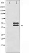 AF6338 staining HeLa by IF/ICC. The sample were fixed with PFA and permeabilized in 0.1% Triton X-100,then blocked in 10% serum for 45 minutes at 25¡ãC. The primary antibody was diluted at 1/200 and incubated with the sample for 1 hour at 37¡ãC. An  Alexa Fluor 594 conjugated goat anti-rabbit IgG (H+L) Ab, diluted at 1/600, was used as the secondary antibod