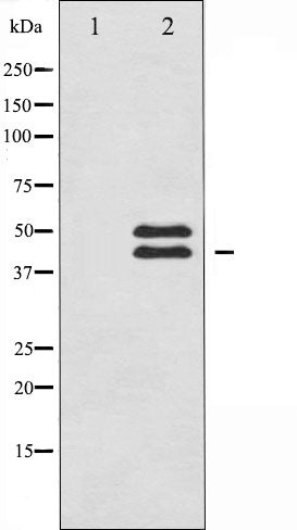 AF6338 staining HeLa by IF/ICC. The sample were fixed with PFA and permeabilized in 0.1% Triton X-100,then blocked in 10% serum for 45 minutes at 25¡ãC. The primary antibody was diluted at 1/200 and incubated with the sample for 1 hour at 37¡ãC. An  Alexa Fluor 594 conjugated goat anti-rabbit IgG (H+L) Ab, diluted at 1/600, was used as the secondary antibod