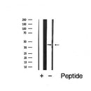 Western blot analysis of extracts from Mouse brain, using CCR5 Antibody. The lane on the left was treated with blocking peptide.