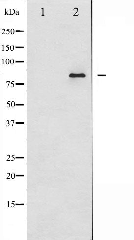 AF6347 at 1/100 staining Human gastric tissue by IHC-P. The sample was formaldehyde fixed and a heat mediated antigen retrieval step in citrate buffer was performed. The sample was then blocked and incubated with the antibody for 1.5 hours at 22¡ãC. An HRP conjugated goat anti-rabbit antibody was used as the secondary