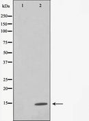 AF6355 staining Hela by IF/ICC. The sample were fixed with PFA and permeabilized in 0.1% Triton X-100,then blocked in 10% serum for 45 minutes at 25¡ãC. The primary antibody was diluted at 1/200 and incubated with the sample for 1 hour at 37¡ãC. An  Alexa Fluor 594 conjugated goat anti-rabbit IgG (H+L) Ab, diluted at 1/600, was used as the secondary antibod