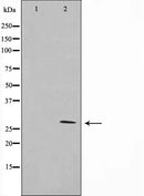 AF6357 at 1/100 staining Human heart tissue by IHC-P. The sample was formaldehyde fixed and a heat mediated antigen retrieval step in citrate buffer was performed. The sample was then blocked and incubated with the antibody for 1.5 hours at 22¡ãC. An HRP conjugated goat anti-rabbit antibody was used as the secondary