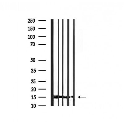Western blot analysis of extracts from 293t, using Histone H3 Antibody. The lane on the left was treated with blocking peptide.