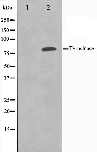 Western blot analysis on COS7 cell lysate using Tyrosinase Antibody.The lane on the left is treated with the antigen-specific peptide.