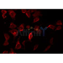 Western blot analysis of extracts from B16F10, using XIAP Antibody. Lane 1 was treated with the blocking peptide.