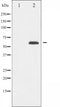AF6369 staining HuvEc by IF/ICC. The sample were fixed with PFA and permeabilized in 0.1% Triton X-100,then blocked in 10% serum for 45 minutes at 25¡ãC. The primary antibody was diluted at 1/200 and incubated with the sample for 1 hour at 37¡ãC. An  Alexa Fluor 594 conjugated goat anti-rabbit IgG (H+L) Ab, diluted at 1/600, was used as the secondary antibod