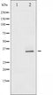 AF6371 staining COS7 by IF/ICC. The sample were fixed with PFA and permeabilized in 0.1% Triton X-100,then blocked in 10% serum for 45 minutes at 25¡ãC. The primary antibody was diluted at 1/200 and incubated with the sample for 1 hour at 37¡ãC. An  Alexa Fluor 594 conjugated goat anti-rabbit IgG (H+L) Ab, diluted at 1/600, was used as the secondary antibod