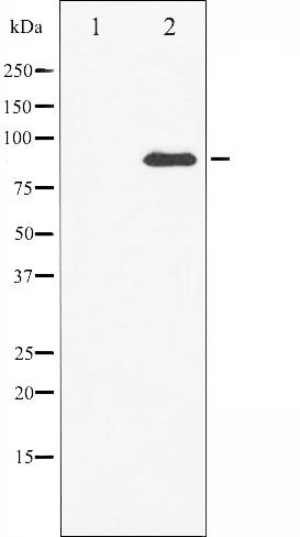 AF6372 at 1/100 staining Human breast cancer tissue by IHC-P. The sample was formaldehyde fixed and a heat mediated antigen retrieval step in citrate buffer was performed. The sample was then blocked and incubated with the antibody for 1.5 hours at 22¡ãC. An HRP conjugated goat anti-rabbit antibody was used as the secondary