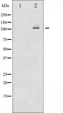 AF6373 at 1/100 staining Human breast cancer tissue by IHC-P. The sample was formaldehyde fixed and a heat mediated antigen retrieval step in citrate buffer was performed. The sample was then blocked and incubated with the antibody for 1.5 hours at 22¡ãC. An HRP conjugated goat anti-rabbit antibody was used as the secondary