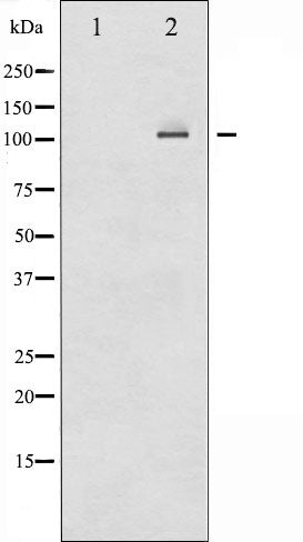 AF6373 at 1/100 staining Human breast cancer tissue by IHC-P. The sample was formaldehyde fixed and a heat mediated antigen retrieval step in citrate buffer was performed. The sample was then blocked and incubated with the antibody for 1.5 hours at 22¡ãC. An HRP conjugated goat anti-rabbit antibody was used as the secondary
