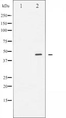 AF6377 staining HeLa by IF/ICC. The sample were fixed with PFA and permeabilized in 0.1% Triton X-100,then blocked in 10% serum for 45 minutes at 25¡ãC. The primary antibody was diluted at 1/200 and incubated with the sample for 1 hour at 37¡ãC. An  Alexa Fluor 594 conjugated goat anti-rabbit IgG (H+L) Ab, diluted at 1/600, was used as the secondary antibod
