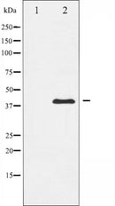 AF6383 at 1/100 staining Human gastric tissue by IHC-P. The sample was formaldehyde fixed and a heat mediated antigen retrieval step in citrate buffer was performed. The sample was then blocked and incubated with the antibody for 1.5 hours at 22¡ãC. An HRP conjugated goat anti-rabbit antibody was used as the secondary