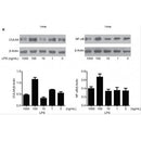 AF6387 at 1/100 staining Human breast cancer tissue by IHC-P. The sample was formaldehyde fixed and a heat mediated antigen retrieval step in citrate buffer was performed. The sample was then blocked and incubated with the antibody for 1.5 hours at 22¡ãC. An HRP conjugated goat anti-rabbit antibody was used as the secondary
