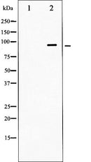 AF6396 at 1/100 staining Human prostate tissue by IHC-P. The sample was formaldehyde fixed and a heat mediated antigen retrieval step in citrate buffer was performed. The sample was then blocked and incubated with the antibody for 1.5 hours at 22¡ãC. An HRP conjugated goat anti-rabbit antibody was used as the secondary