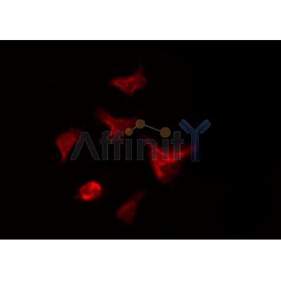 AF0288 staining HeLa by IF/ICC. The sample were fixed with PFA and permeabilized in 0.1% Triton X-100,then blocked in 10% serum for 45 minutes at 25¡ãC. The primary antibody was diluted at 1/200 and incubated with the sample for 1 hour at 37¡ãC. An  Alexa Fluor 594 conjugated goat anti-rabbit IgG (H+L) Ab, diluted at 1/600, was used as the secondary antibod