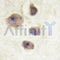 AF6397 at 1/100 staining Human breast cancer tissue by IHC-P. The sample was formaldehyde fixed and a heat mediated antigen retrieval step in citrate buffer was performed. The sample was then blocked and incubated with the antibody for 1.5 hours at 22¡ãC. An HRP conjugated goat anti-rabbit antibody was used as the secondary