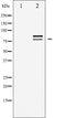 AF6402 at 1/100 staining Human prostate tissue by IHC-P. The sample was formaldehyde fixed and a heat mediated antigen retrieval step in citrate buffer was performed. The sample was then blocked and incubated with the antibody for 1.5 hours at 22¡ãC. An HRP conjugated goat anti-rabbit antibody was used as the secondary