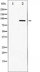 AF6403 at 1/100 staining Human prostate tissue by IHC-P. The sample was formaldehyde fixed and a heat mediated antigen retrieval step in citrate buffer was performed. The sample was then blocked and incubated with the antibody for 1.5 hours at 22¡ãC. An HRP conjugated goat anti-rabbit antibody was used as the secondary