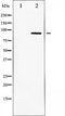 AF6403 at 1/100 staining Human prostate tissue by IHC-P. The sample was formaldehyde fixed and a heat mediated antigen retrieval step in citrate buffer was performed. The sample was then blocked and incubated with the antibody for 1.5 hours at 22¡ãC. An HRP conjugated goat anti-rabbit antibody was used as the secondary