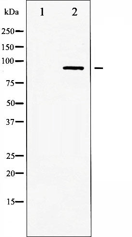 AF6403 at 1/100 staining Human prostate tissue by IHC-P. The sample was formaldehyde fixed and a heat mediated antigen retrieval step in citrate buffer was performed. The sample was then blocked and incubated with the antibody for 1.5 hours at 22¡ãC. An HRP conjugated goat anti-rabbit antibody was used as the secondary