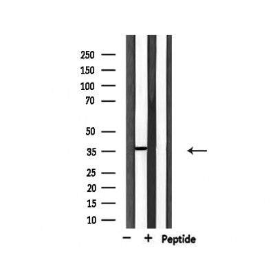 Western blot analysis of extracts from HepG2, using USF2 Antibody.