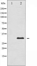 AF6415 at 1/100 staining Human lung tissue by IHC-P. The sample was formaldehyde fixed and a heat mediated antigen retrieval step in citrate buffer was performed. The sample was then blocked and incubated with the antibody for 1.5 hours at 22¡ãC. An HRP conjugated goat anti-rabbit antibody was used as the secondary
