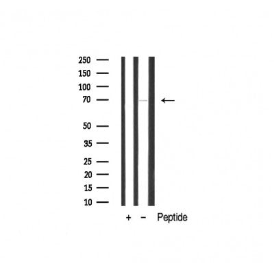 Western blot analysis of extracts from various samples, using FKHR Antibody.
 Lane 1: 3t3 treated with blocking peptide;
 Lane 2: 3t3;
Lane 3: Mouse spleen.