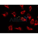 Western blot analysis of extracts from 3t3, using ACC1 Antibody. Lane 1 was treated with the blocking peptide.