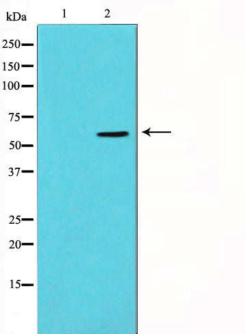 Western blot analysis on 293 cell lysate using Vimentin Antibody.The lane on the left is treated with the antigen-specific peptide.