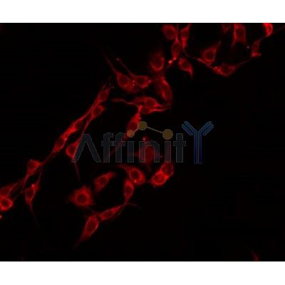 AF0292 staining 293 by IF/ICC. The sample were fixed with PFA and permeabilized in 0.1% Triton X-100,then blocked in 10% serum for 45 minutes at 25¡ãC. The primary antibody was diluted at 1/200 and incubated with the sample for 1 hour at 37¡ãC. An  Alexa Fluor 594 conjugated goat anti-rabbit IgG (H+L) Ab, diluted at 1/600, was used as the secondary antibod