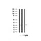 Western blot analysis on mouse brain lysate using 14-3-3 beta/? Antibody.The lane on the right is treated with the antigen-specific peptide.