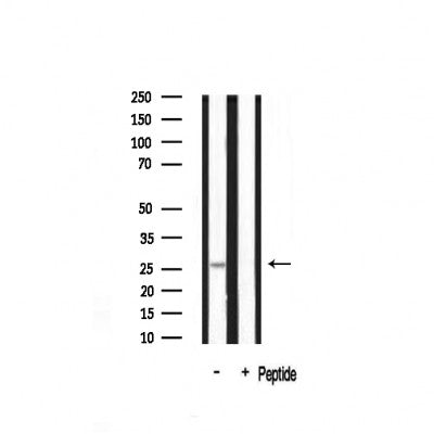 Western blot analysis on mouse brain lysate using 14-3-3 beta/? Antibody.The lane on the right is treated with the antigen-specific peptide.