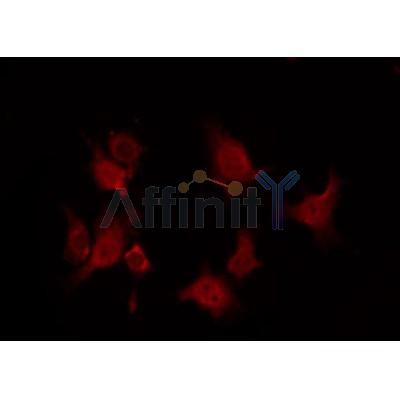 AF0097 staining RAW264.7 by IF/ICC. The sample were fixed with PFA and permeabilized in 0.1% Triton X-100,then blocked in 10% serum for 45 minutes at 25¡ãC. The primary antibody was diluted at 1/200 and incubated with the sample for 1 hour at 37¡ãC. An  Alexa Fluor 594 conjugated goat anti-rabbit IgG (H+L) Ab, diluted at 1/600, was used as the secondary antibod