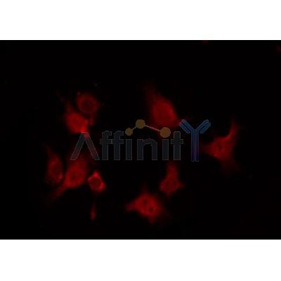 AF0097 staining RAW264.7 by IF/ICC. The sample were fixed with PFA and permeabilized in 0.1% Triton X-100,then blocked in 10% serum for 45 minutes at 25¡ãC. The primary antibody was diluted at 1/200 and incubated with the sample for 1 hour at 37¡ãC. An  Alexa Fluor 594 conjugated goat anti-rabbit IgG (H+L) Ab, diluted at 1/600, was used as the secondary antibod