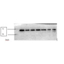 AF6423 at 1/100 staining Human breast cancer tissue by IHC-P. The sample was formaldehyde fixed and a heat mediated antigen retrieval step in citrate buffer was performed. The sample was then blocked and incubated with the antibody for 1.5 hours at 22¡ãC. An HRP conjugated goat anti-rabbit antibody was used as the secondary